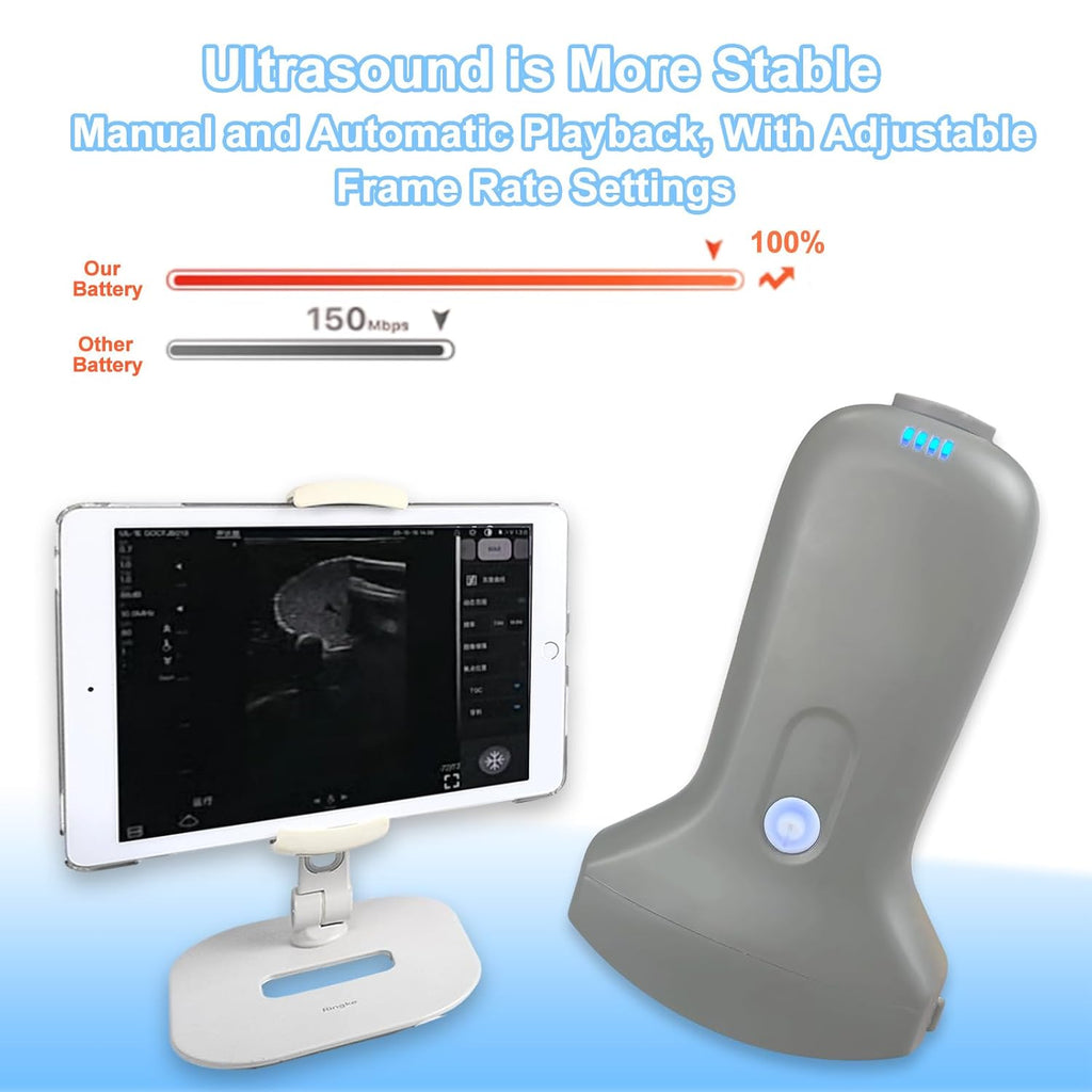Wireless Convex Abdominal Ultrasound Probe - Handheld Portable Scanner & Medical Training Device for Clinical