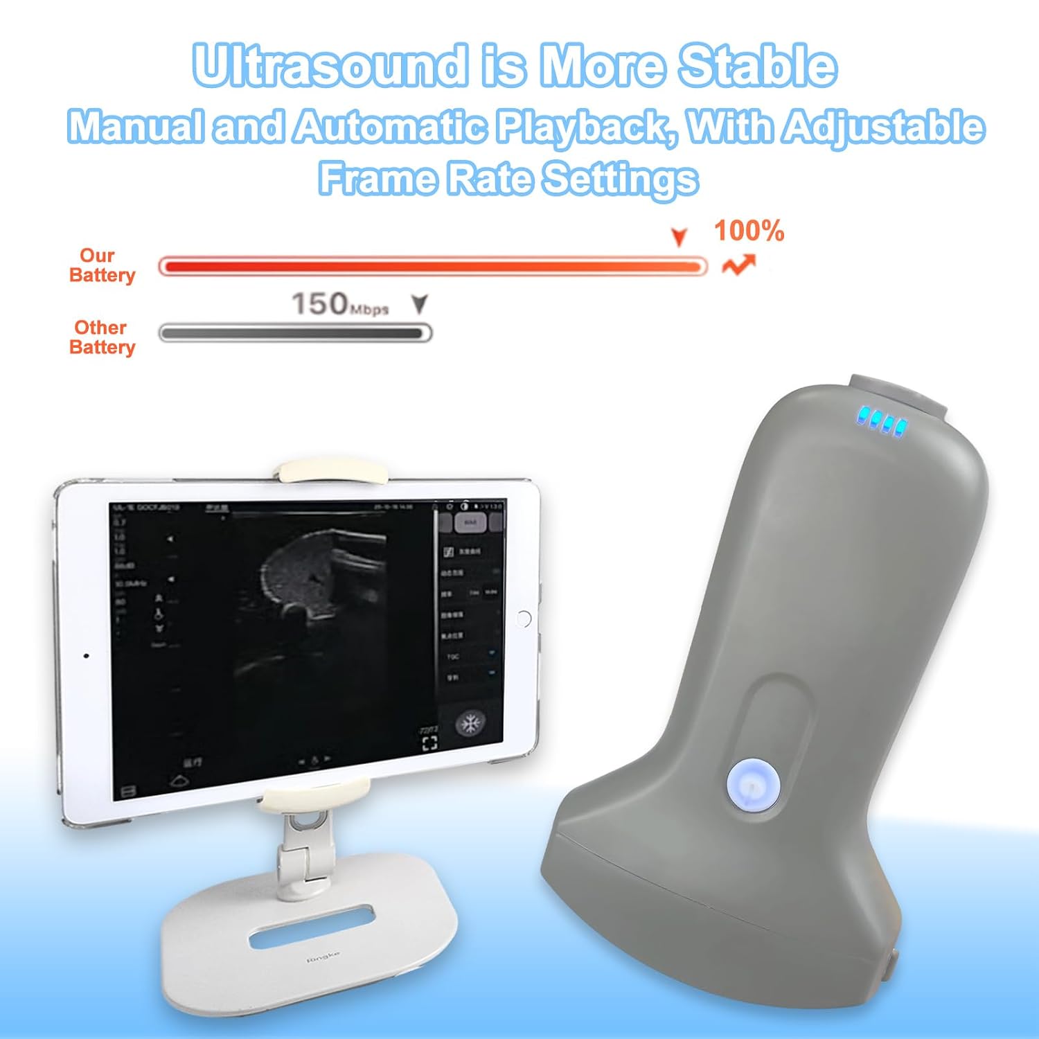 Wireless Convex Abdominal Ultrasound Probe - Handheld Portable Scanner & Medical Training Device for Clinical