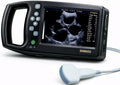 A8 Professional Veterinary Ultrasound Machine with 3.5MHz Convex Probe