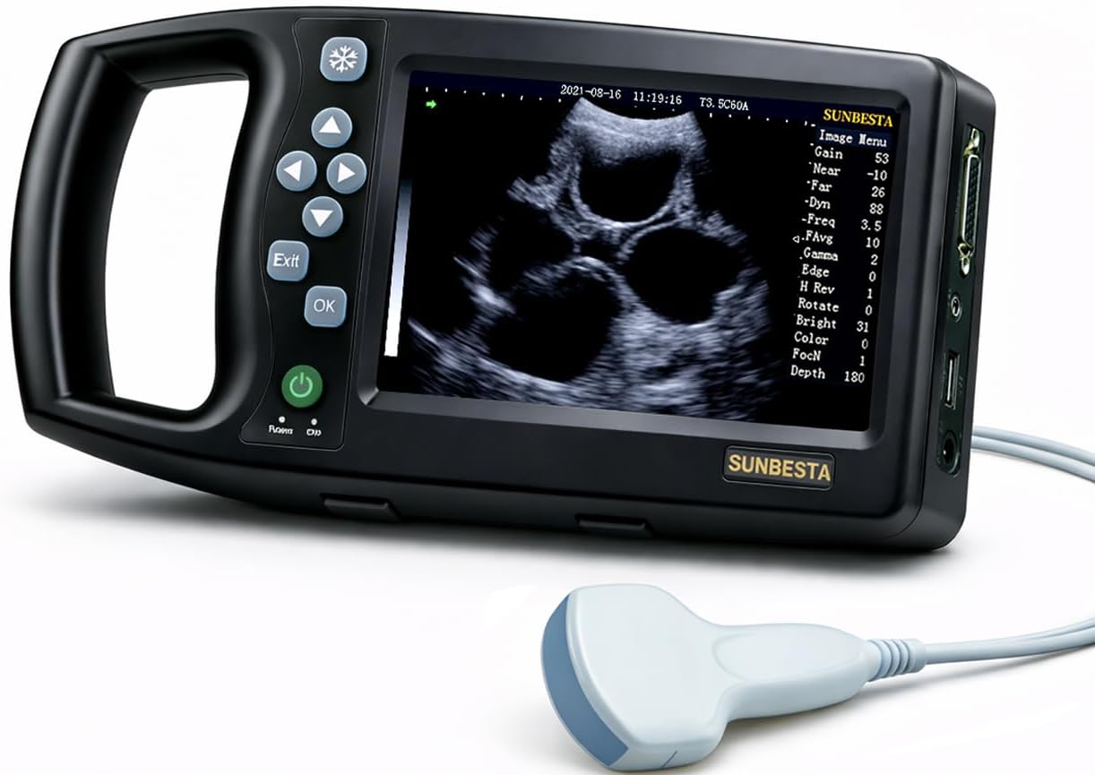 A8 Professional Veterinary Ultrasound Machine with 3.5MHz Convex Probe
