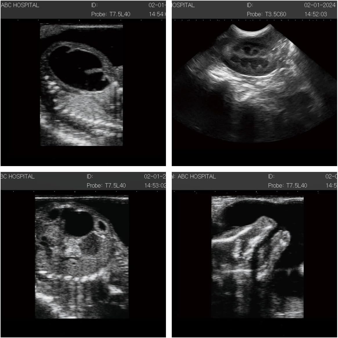 N50 Portable Veterinary Ultrasound Machine with 3.5 Mhz Convex Probe