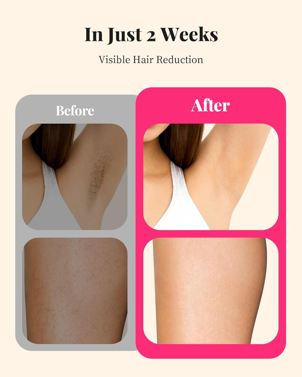 Laser Hair Removal for Women and Men, At-Home IPL Hair Removal Device with 5.2 cm² Treatment Window, Nearly Painless