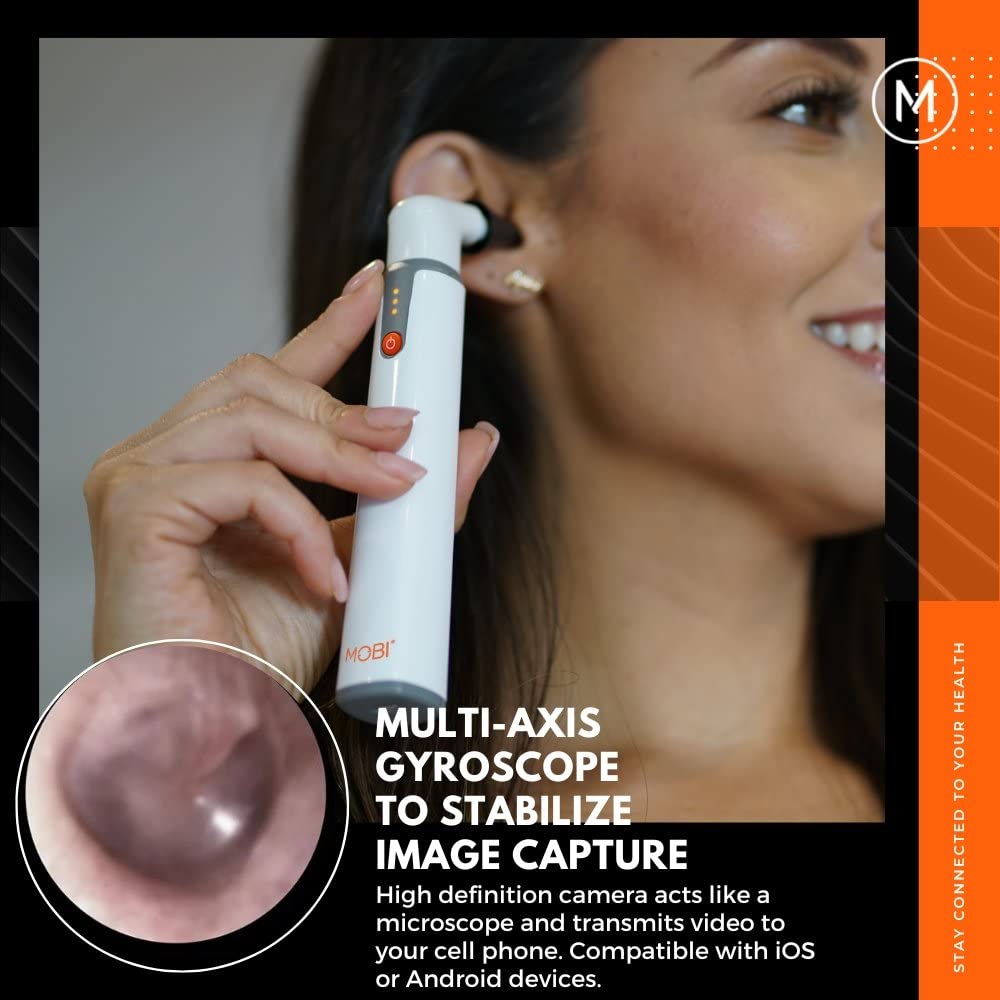 Smart Otoscope for Ears, Nose & Throat, 1080P HD Ear Camera with App for Adults & Kids, Rechargeable Digital Otoscope