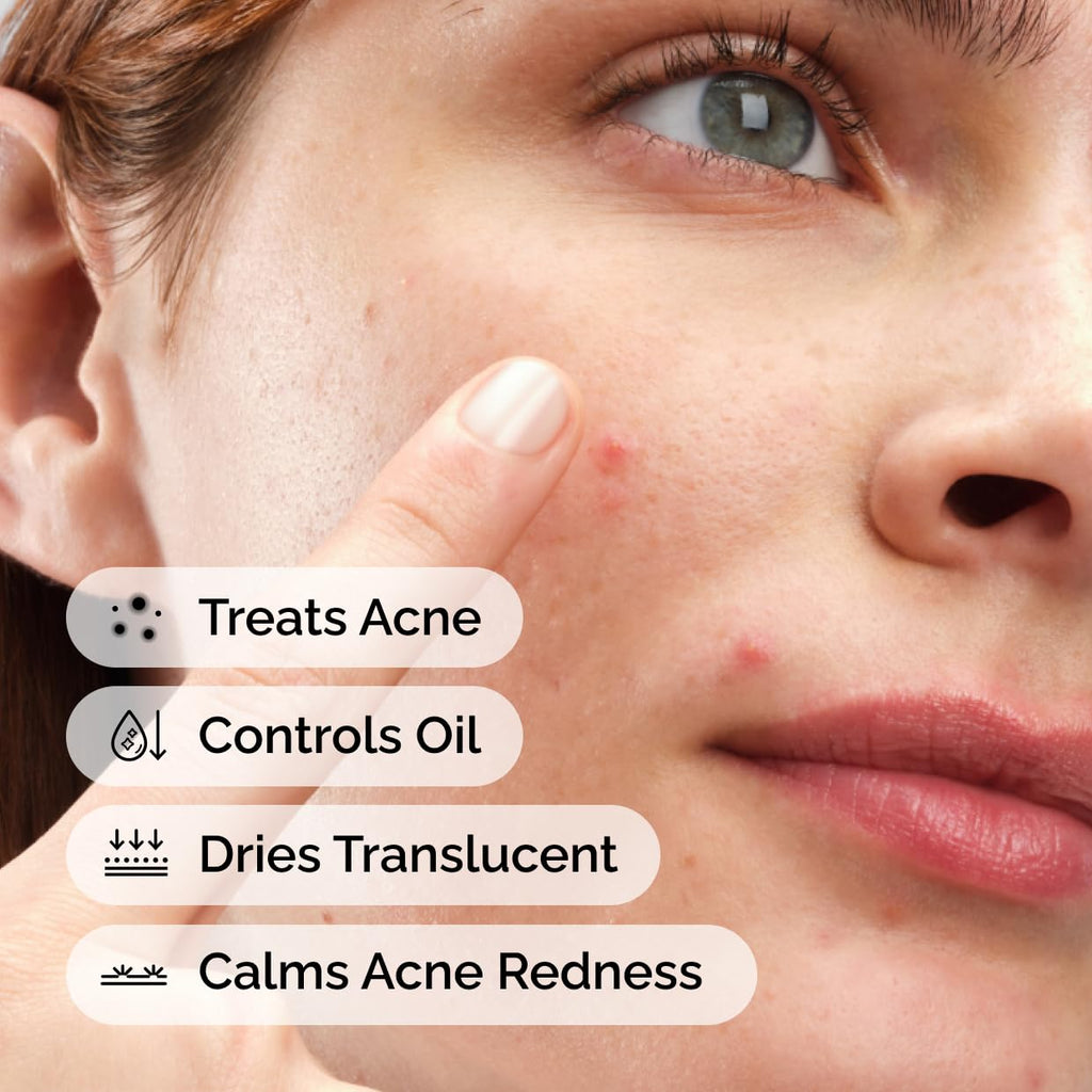 Sulfur 10% Powder-to-Cream Acne Spot Treatment Concentrate, Reduces Pimple Size and Zit Redness, 0.18 Oz