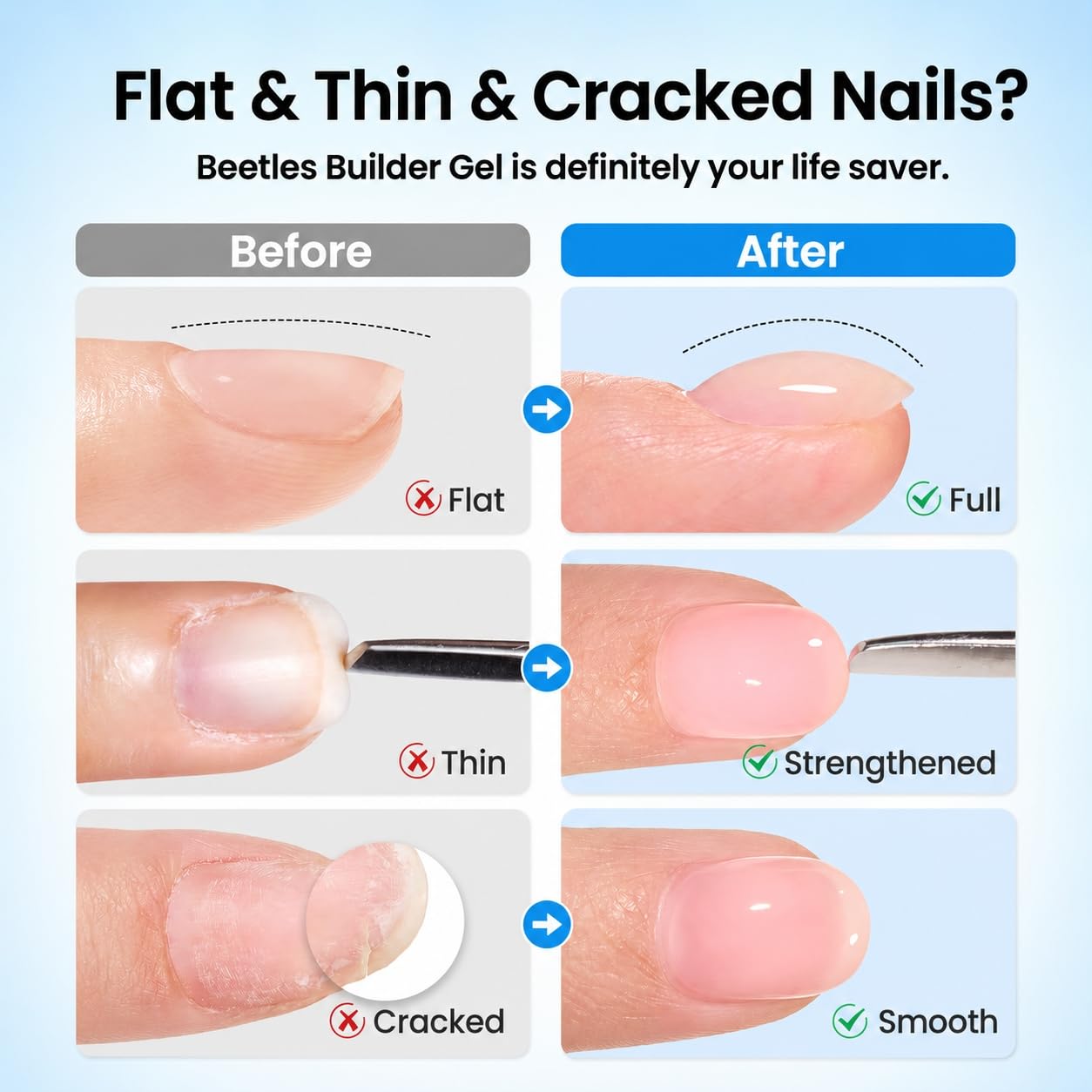 Beetles 3Pcs 15 ml Builder Nail Gel with Base and No Wipe Top Coat | Gel Polish Kit for Gloss Finish and Long-Lasting