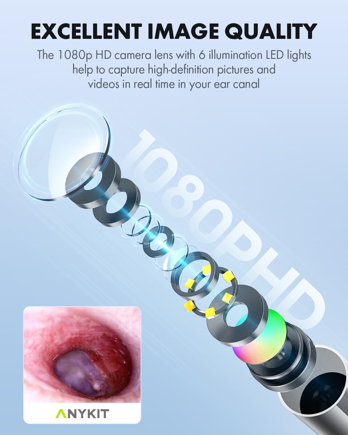 Digital Otoscope with Gyroscope, HD Ultra Clear View Ear Camera with Ear Wax Removal Tools, Video Ear Scope Otoscope