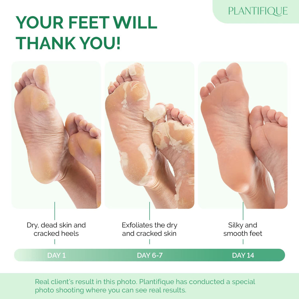 Foot Peeling Mask, Dermatologically Tested - 2 Pairs, Peach | Repairs Heels & Removes Dry Dead Skin for Baby Soft