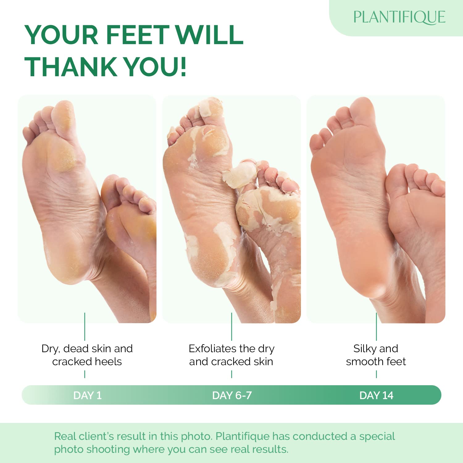 Foot Peeling Mask, Dermatologically Tested - 2 Pairs, Peach | Repairs Heels & Removes Dry Dead Skin for Baby Soft