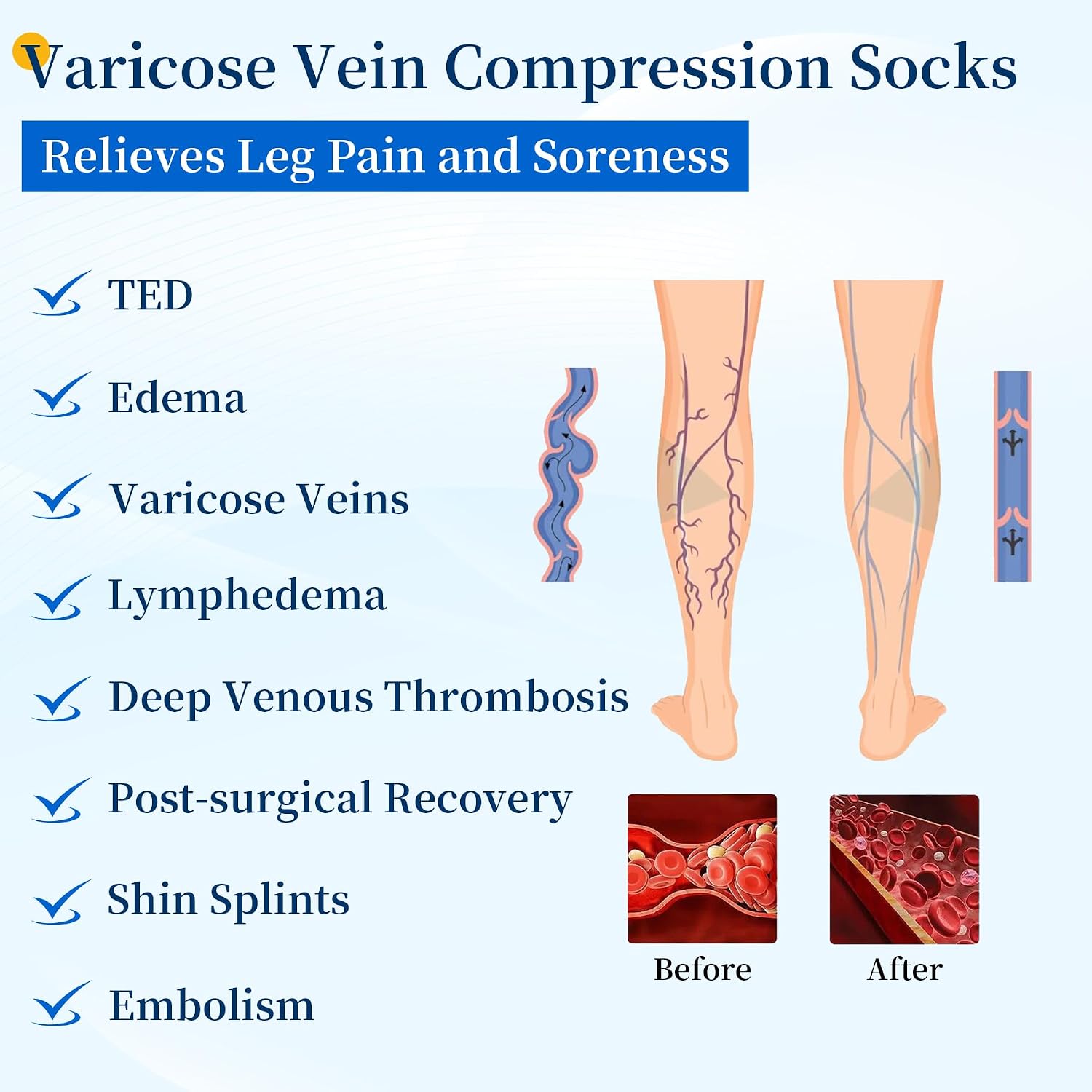 20-30mmHg Thigh High Compression Stockings for Women & Men, Footless Over the Knee Compression Socks with Silicone