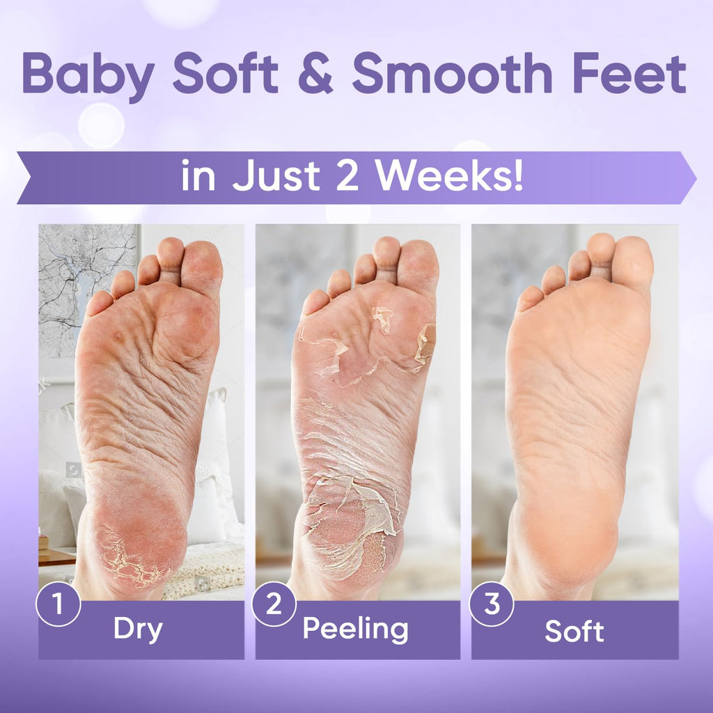 Foot Peeling Mask for Dry Cracked Feet | Foot Mask to Exfoliate Rough, Cracked, Dry Feet, Calluses for Soft Baby Feet