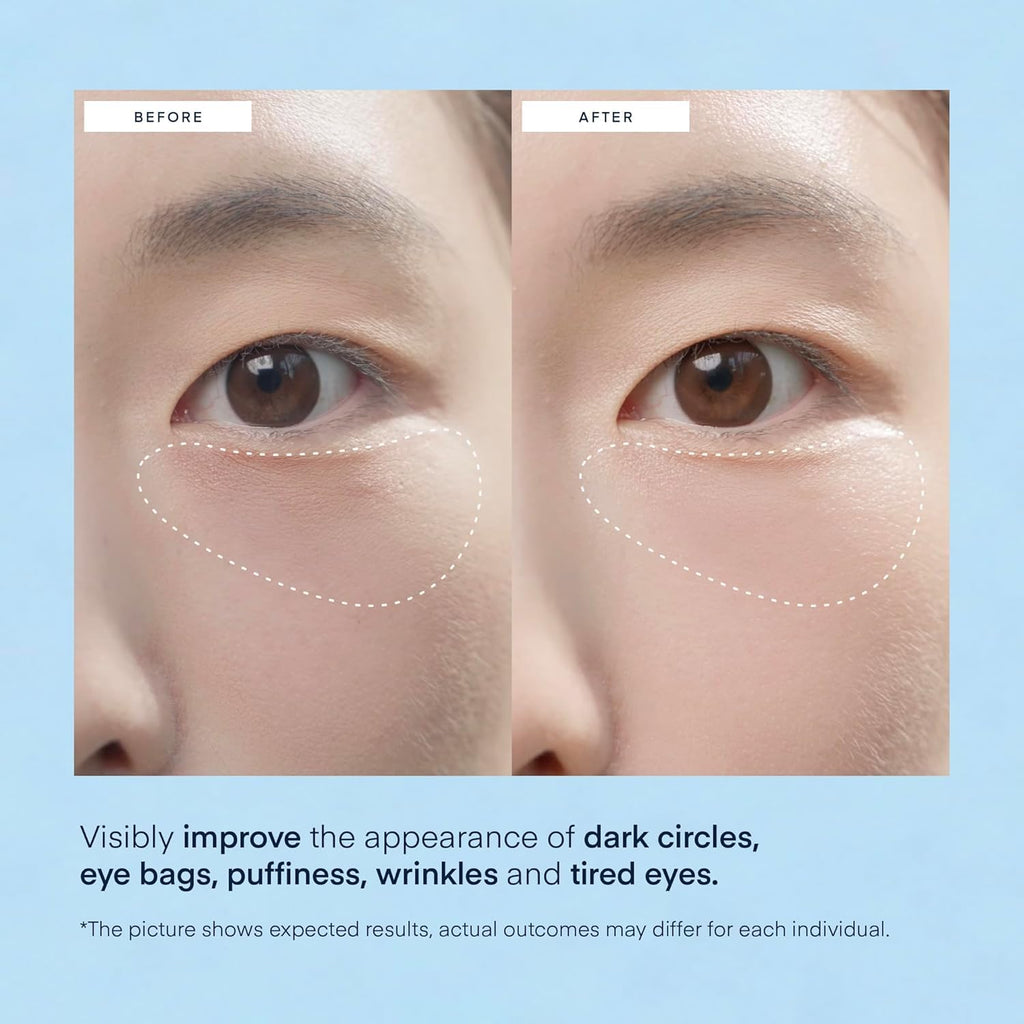 Under Eye Patches for Dark Circles - 60 Korean Hydrogel Masks for Puffiness, Bags, Wrinkle with Caffeine, Hyaluronic