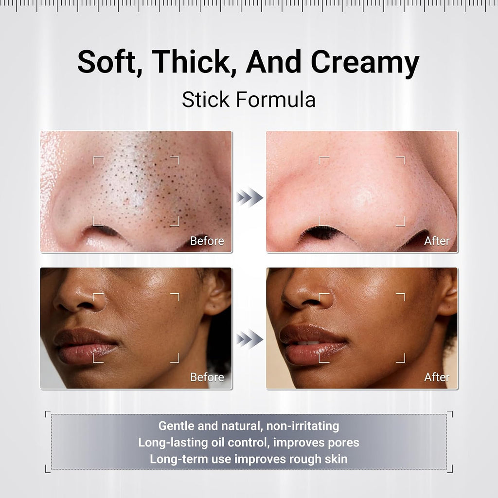 Blackhead Remover Clay Mask Stick, Volcanic Mud & Kaolin, 1.58oz | Charcoal clay mask stick for deep pore detox