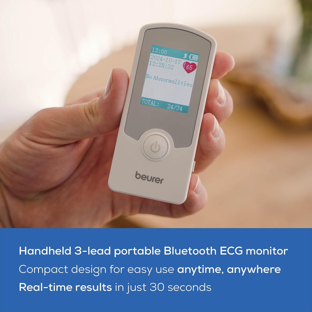 Cardio Companion EKG Monitor - 3-Lead Portable ECG Machine, Detects Irregular Heart Rhythms, Fast Results in 30