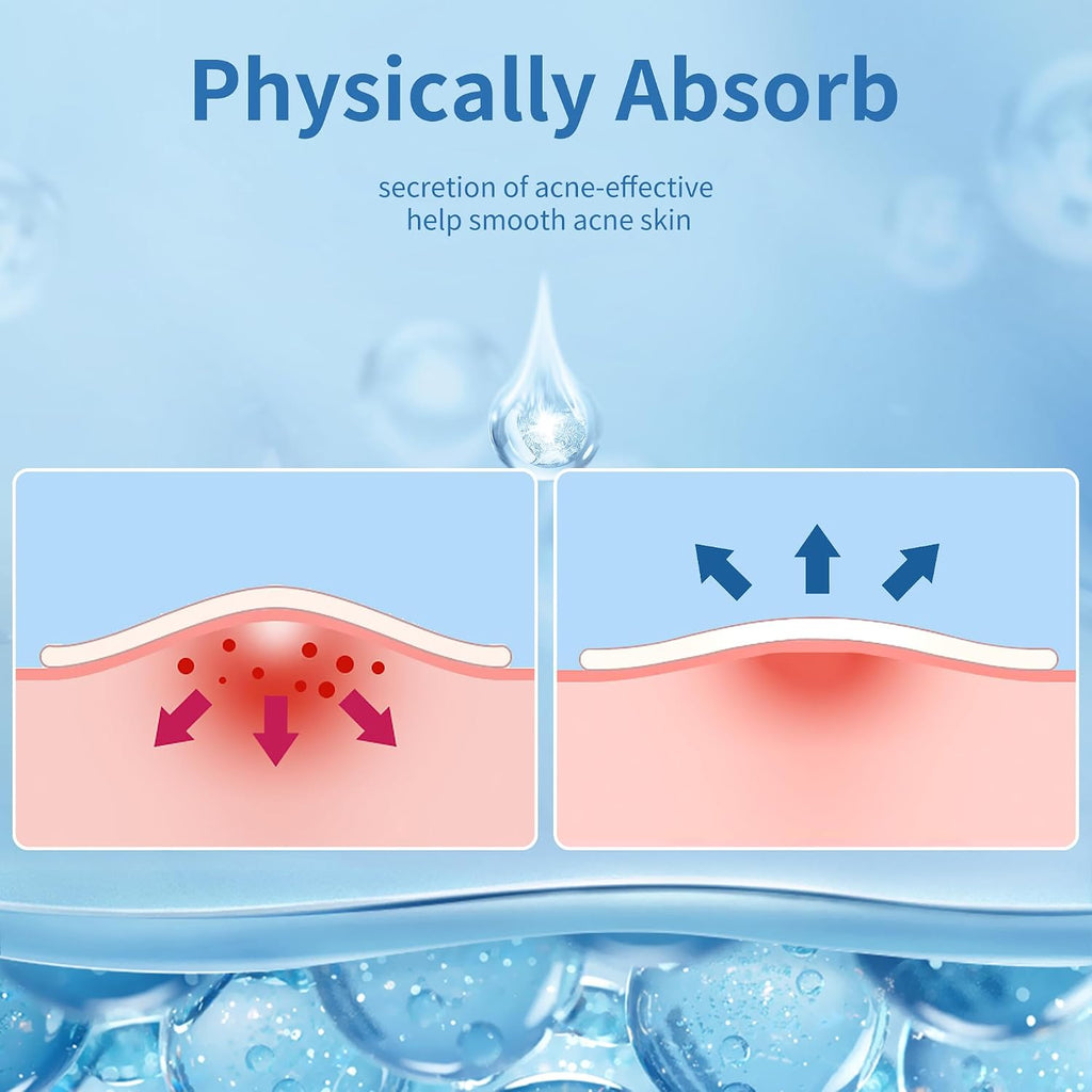 Pimple Patches for Face, 4 Size 300 Counts Acne Patches, Hydrocolloid Patches for Covering Zits and Blemishes, Spot