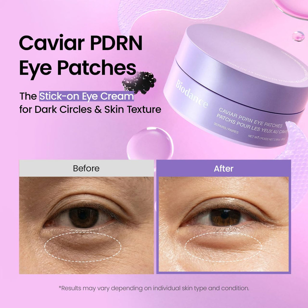 Caviar PDRN Eye Patches, Nourishing Under Eye Patches for Dark Circles, Depuffing Eye Mask for Puffy & Tired Eyes