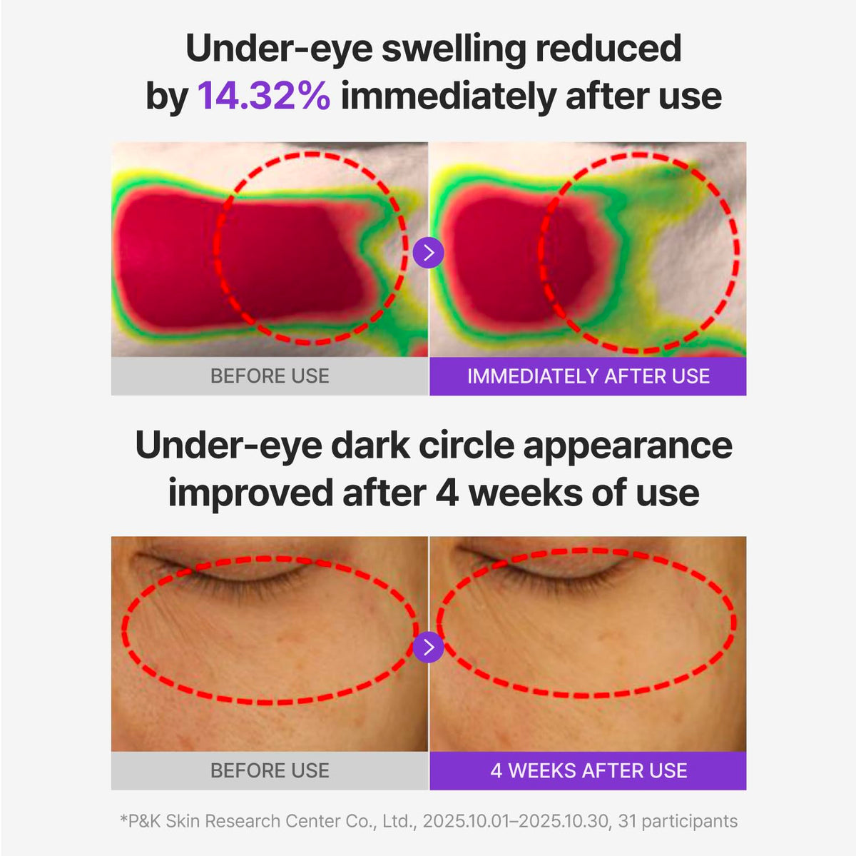 360 Shot PDRN Glowing Eye Patch, TECA Dark Circles (6 Pairs)