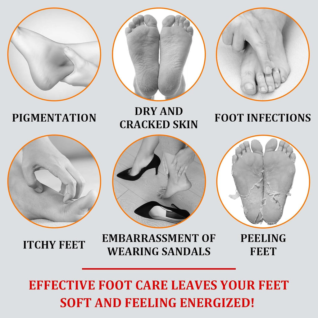 Foot Peeling Spray Oil,Moisturizing Nourishing Foot Exfoliating Peeling Spray,Instantly Hydrating Gently Foot Peel