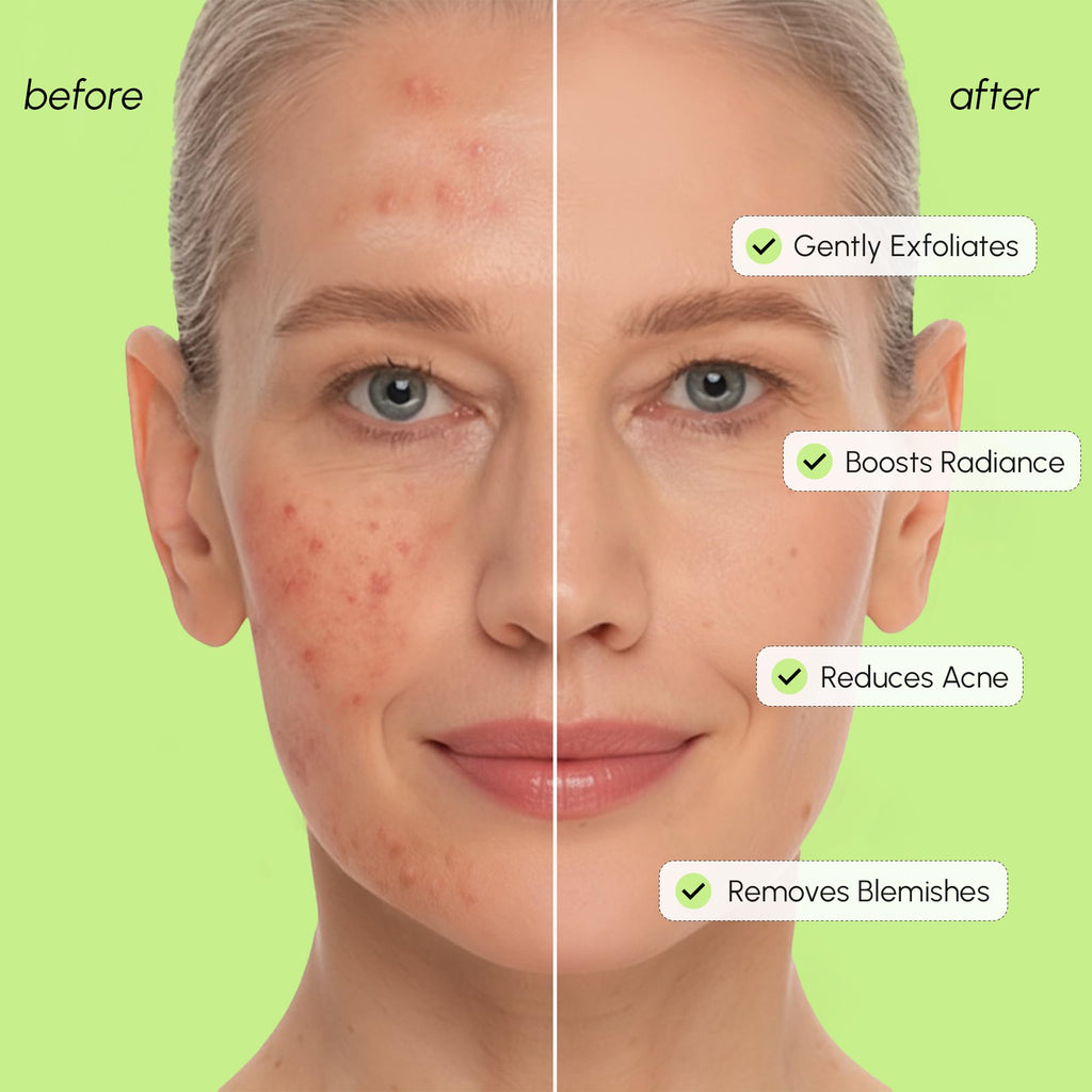 Exfoliating Salicylic Acid Toner for Face Exfoliator Pore Cleaner