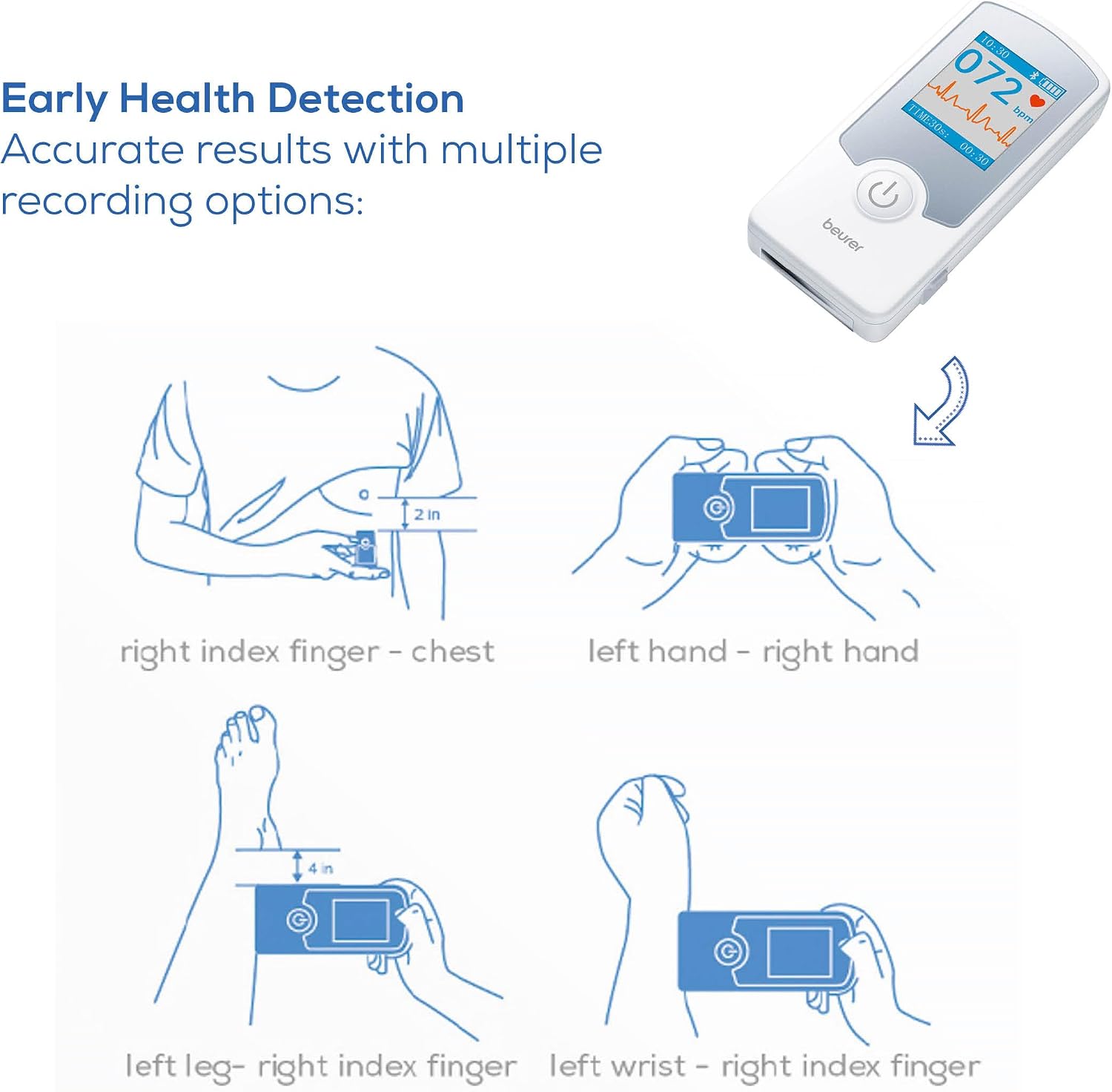Cardio Companion EKG Monitor - 3-Lead Portable ECG Machine, Detects Irregular Heart Rhythms, Fast Results in 30