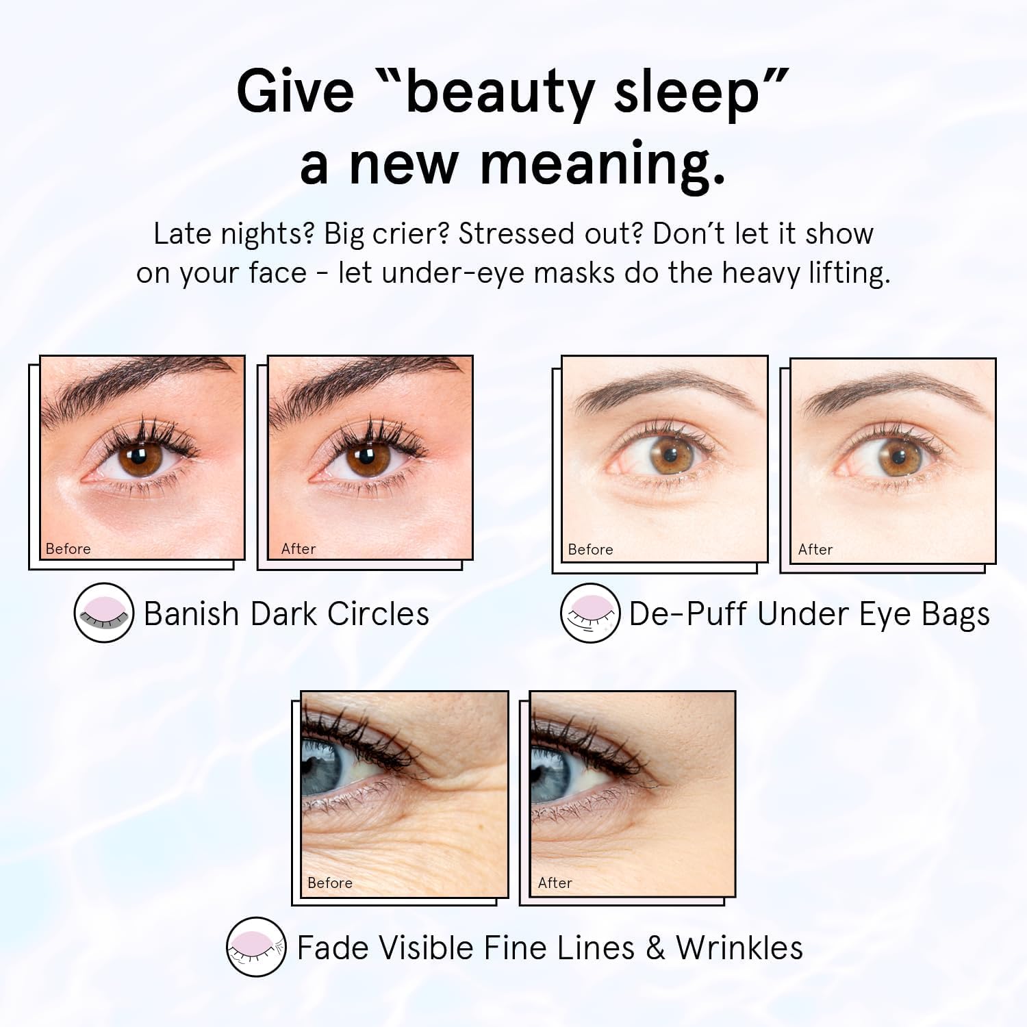 Retinol Under Eye Patches for Puffy Eyes | Restoring Gel Under Eye Masks with Hyaluronic Acid - Birthday Gifts for
