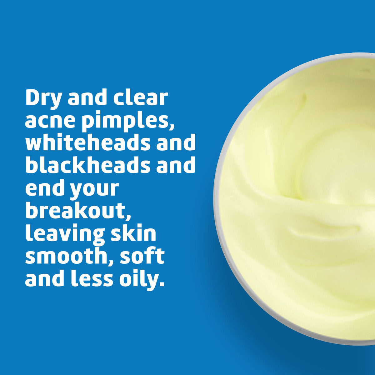 10% Sulfur Ointment, Cystic Acne Treatment Face & Body 5.5 oz