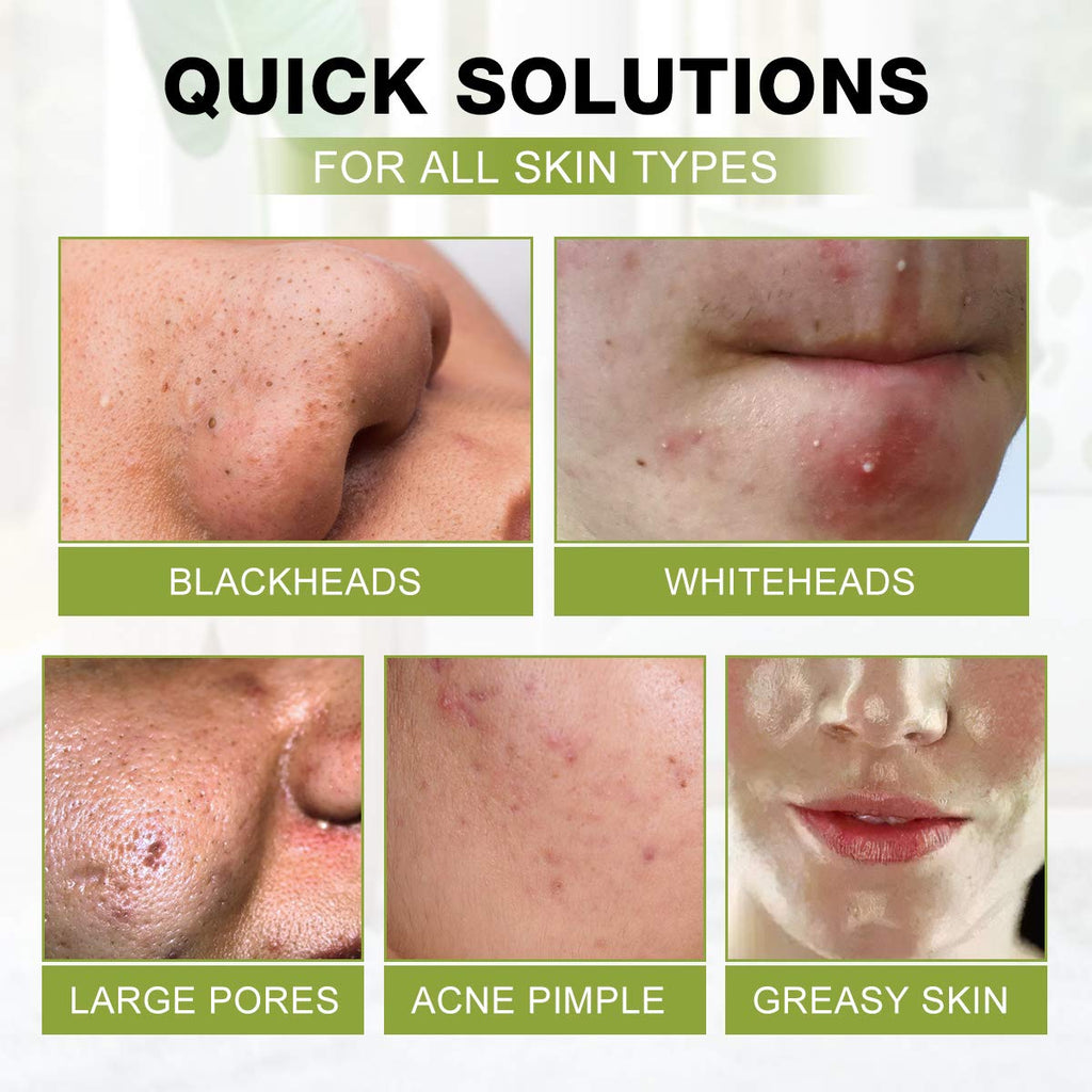 Blackhead Peel Off Face Mask, SHVYOG 3-in-1 Blackhead Remover Mask with Brush & Tea Tree Oil Serum, Charcoal Face