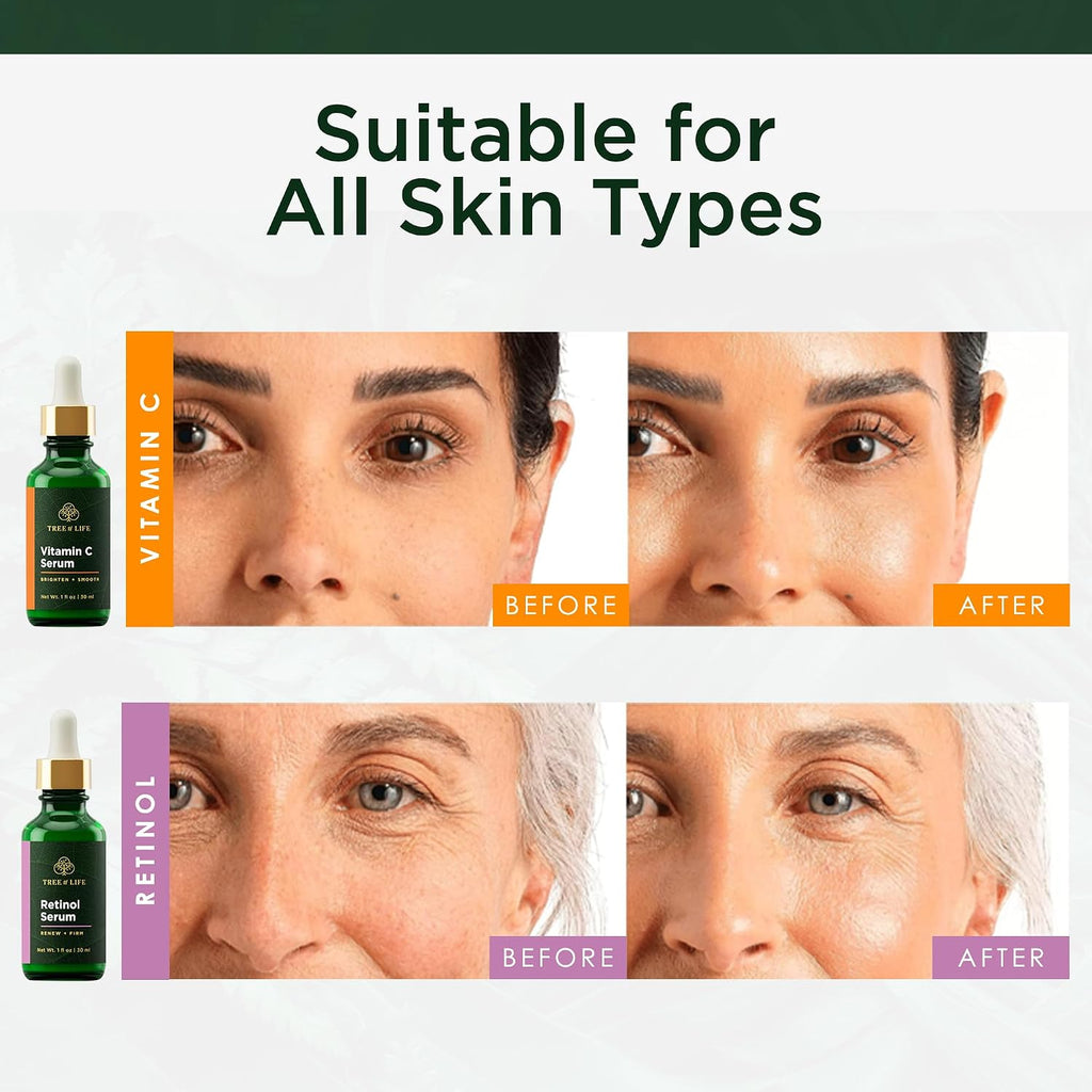 Beauty Facial Skin Care Set, Brightening, Firming, Hydrating, Dry Face, Dermatologist Tested - Vitamin C Serum