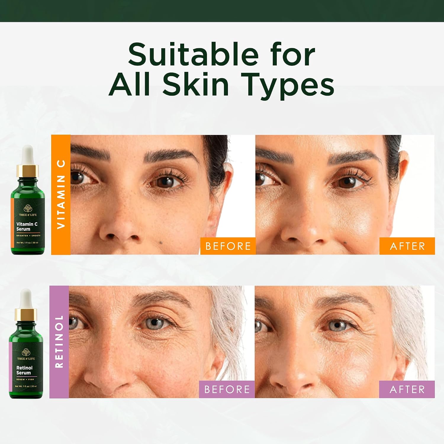 Beauty Facial Skin Care Set, Brightening, Firming, Hydrating, Dry Face, Dermatologist Tested - Vitamin C Serum