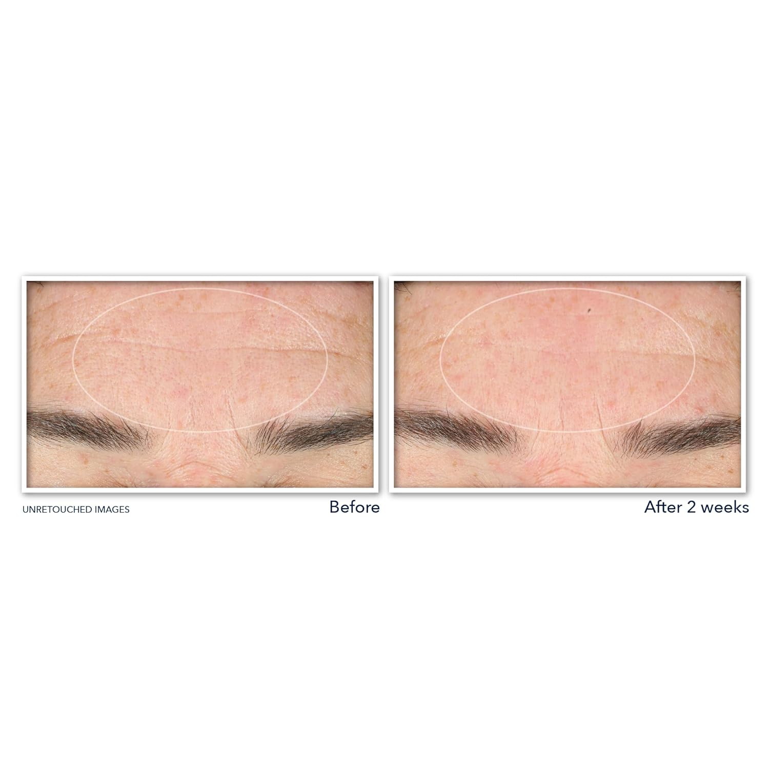 Derm Correxion Serum Facial Cleanser with Niacinamide and Amino Acids for Anti-Aging & Fine Lines, Makeup Remover, 6