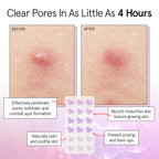 Award Winning Pore Strip - Pimple Patches for Face