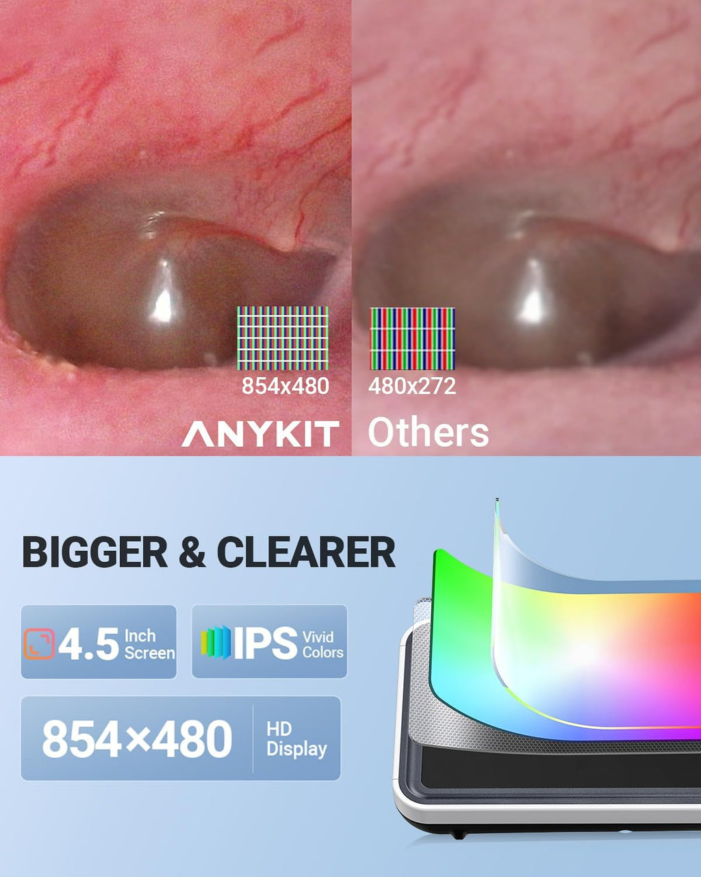 Digital Otoscope with Gyroscope, 4.5 Inches Screen, 3.9mm Ear Scope Camera with 6 Lights, Ear Wax Removal Tool, 32GB
