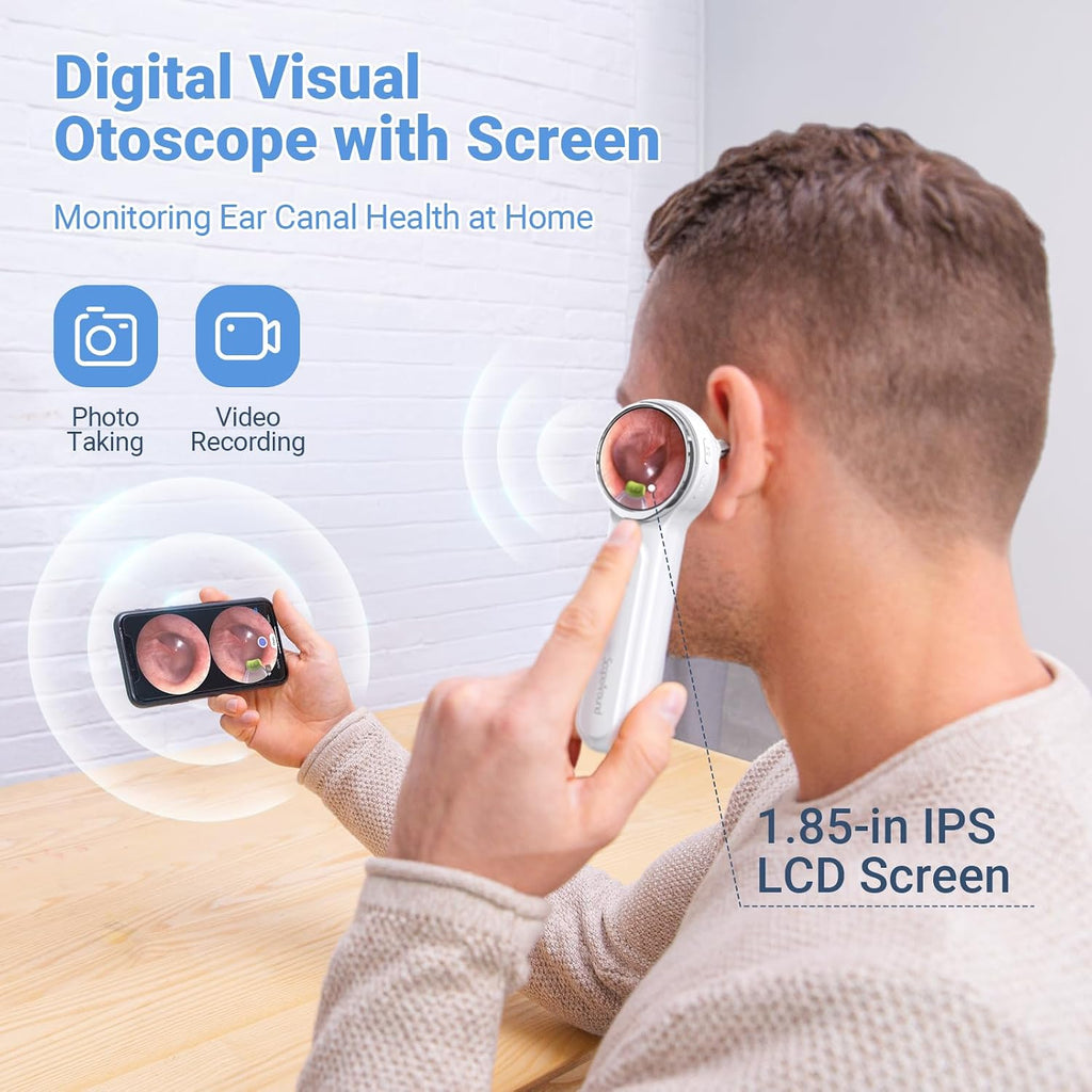 Wireless Digital Otoscope with Built-in Screen and Lights for Home Use