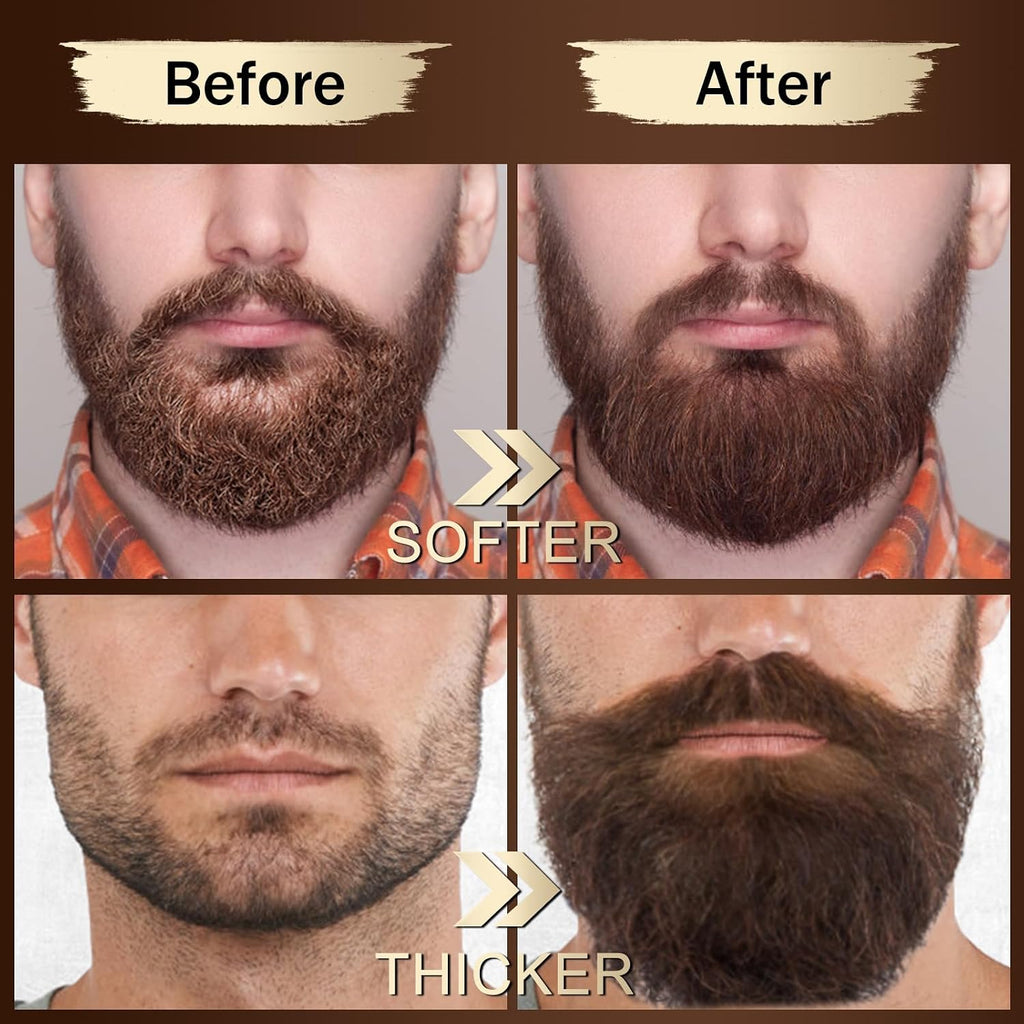 Beard Kit for Men Grooming & Care Set w/2 Pack Beard Serum, Wash, Oil, Balm, Comb, Brush, Scissor, Bag, EBook, Unique