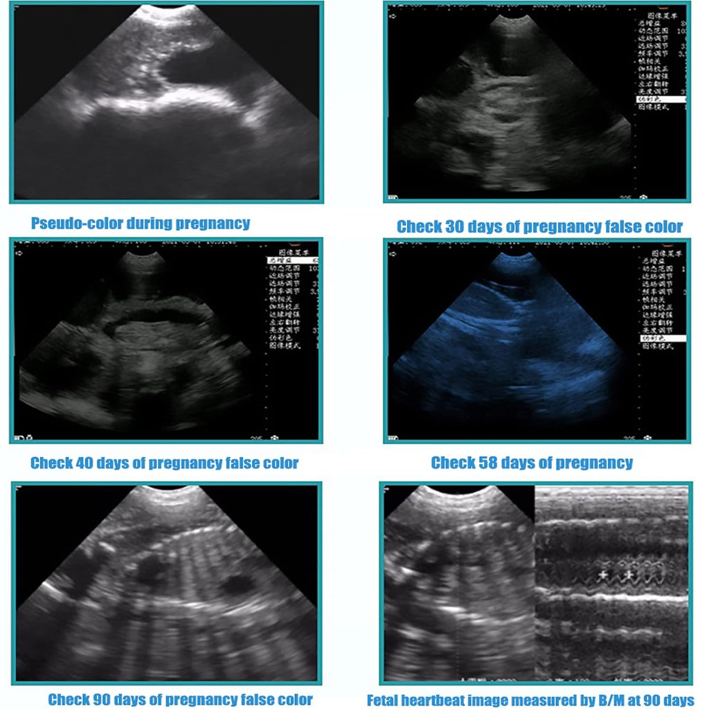 Dog Pregnancy Test Ultrasound Scanner Veterinary Machine Laptop 12 Inch Portable Black White Doppler Farm Animals