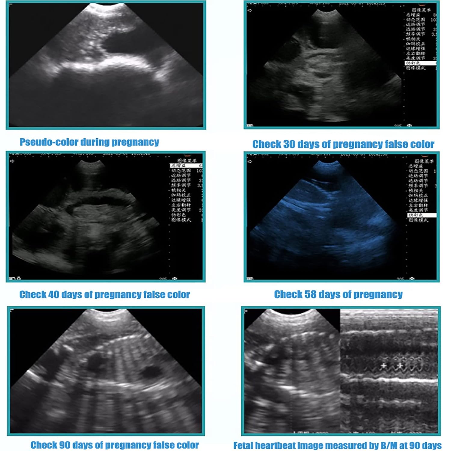 Dog Pregnancy Test Ultrasound Scanner Veterinary Machine Laptop 12 Inch Portable Black White Doppler Farm Animals