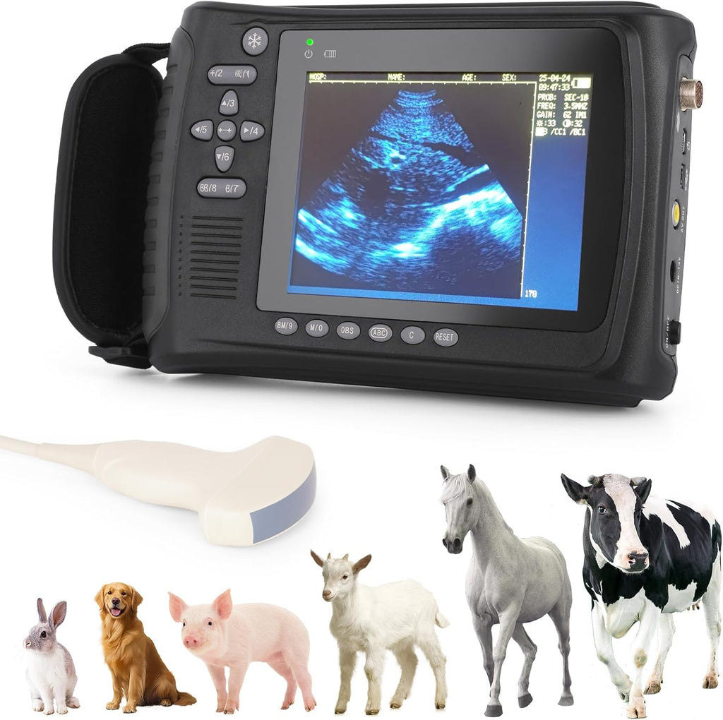 Portable Ultrasound Machine for Pregnancy - with Convex Probe & 5 Imaging Modes, Pregnancy Digital Ultrasound Machine