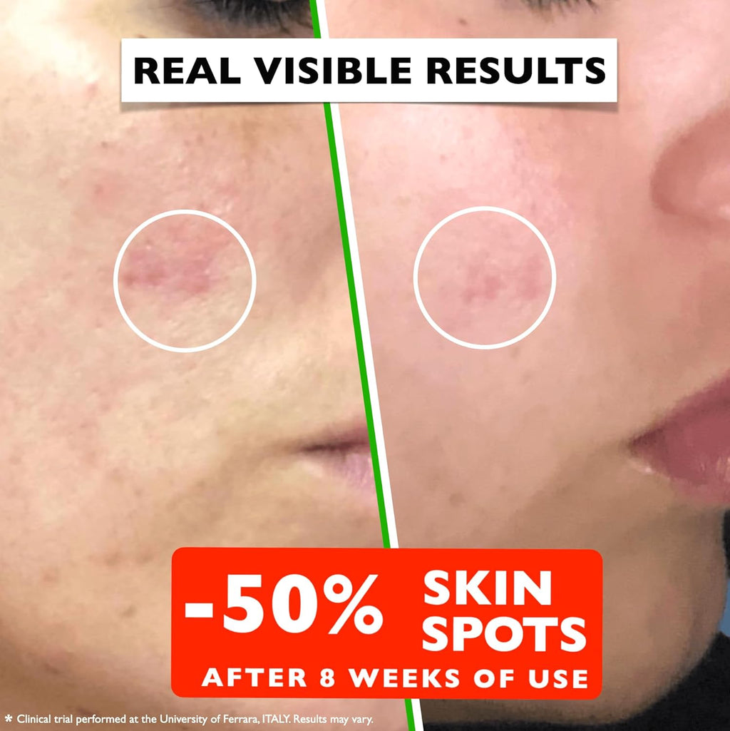 Vitamin C Serum For Face – Anti Aging Face Serum with Vitamin C, Hyaluronic Acid, Vitamin E. Brightening Formula.