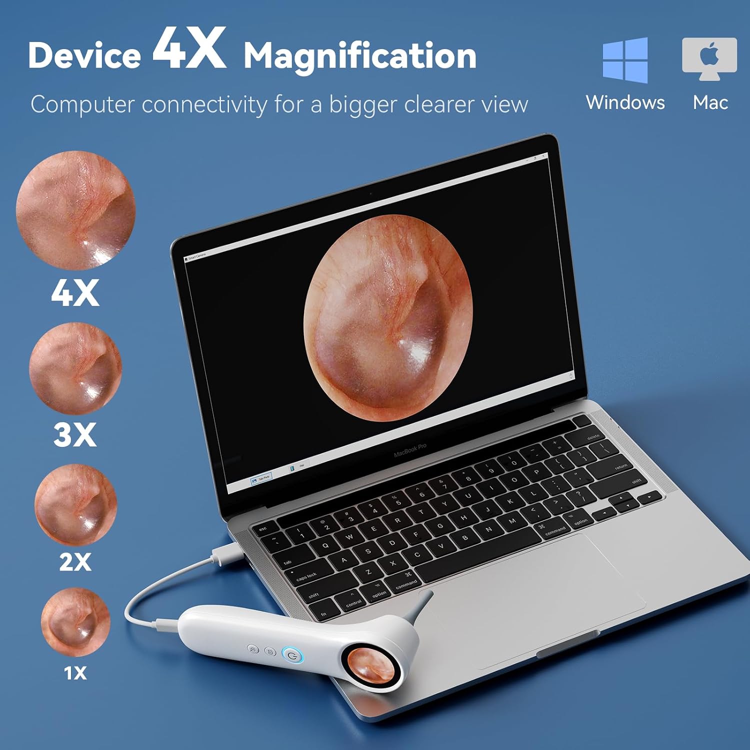 1080P HD Otoscope with 1.21'' Screen, Cleaner Camera for Family