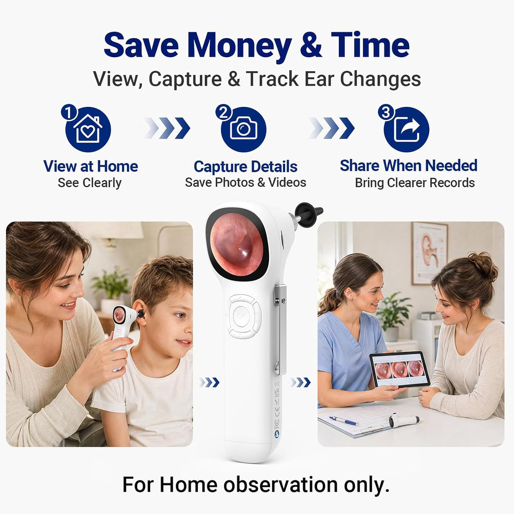 Otoscope with Light, No App Needed, HD Screen, Ear Scope Camera for Family | Ear Camera with Earwax Removal Kit for