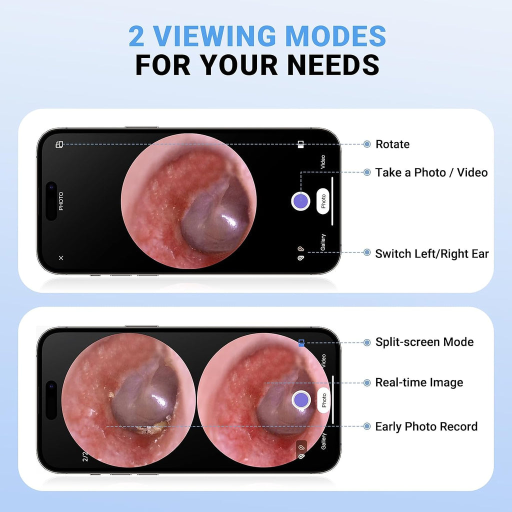 Wireless Digital Otoscope with Built-in Screen and Lights for Home Use