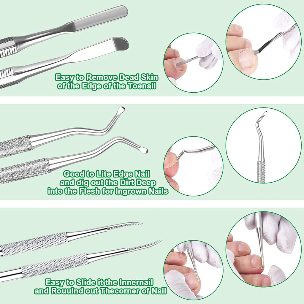 6-Pack Ingrown Toenail File and Lifters, Professional Surgical Stainless Steel Ingrown Toenail Removal Tool Kit