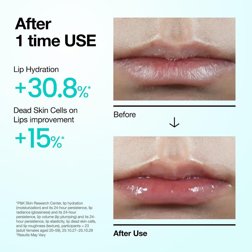 PDRN Lip Serum, 0.33 fl.oz