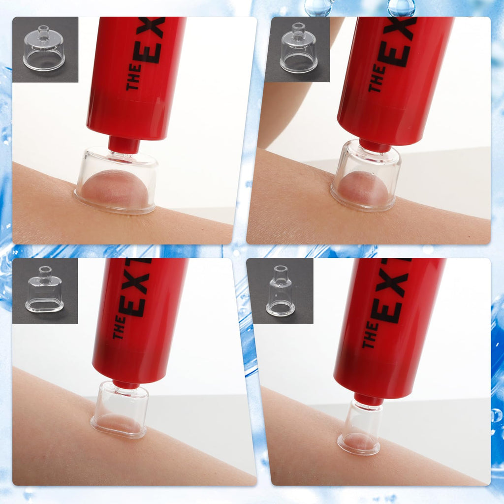 Snake Bite Kit Sting Kit Venom Extractor Suction Pump Emergency Sting Bite Kit First Aid Supplies for Backpacking