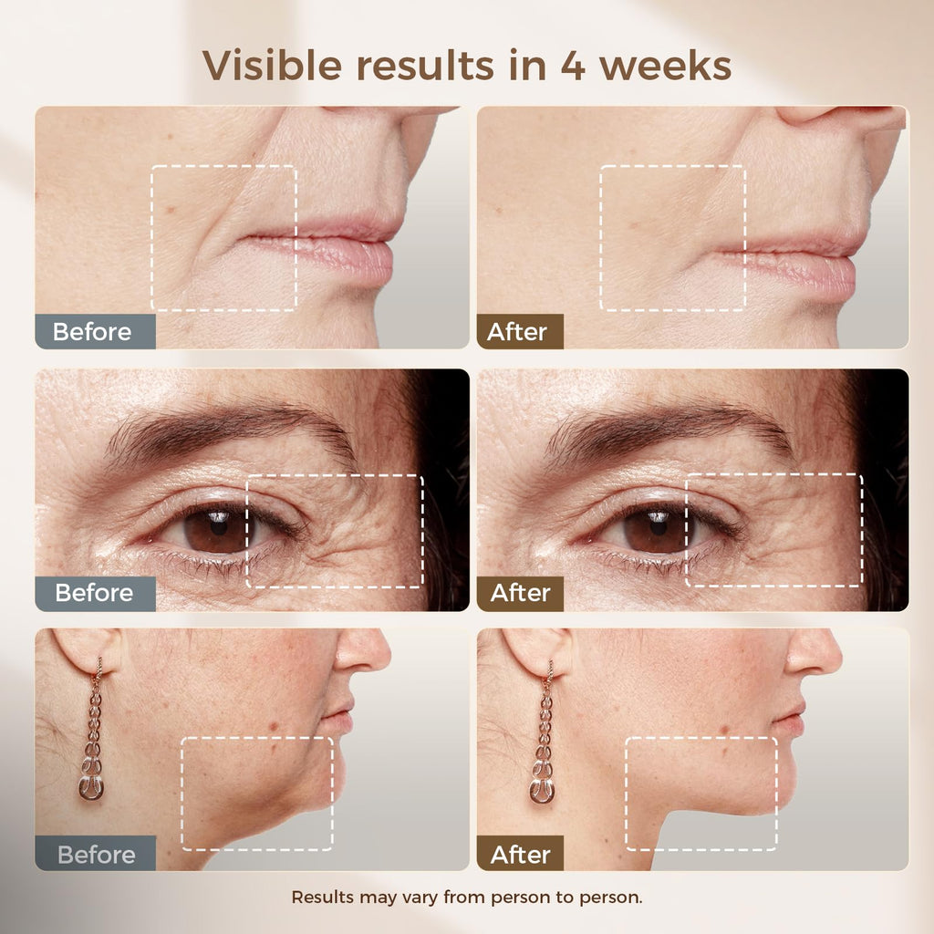 Microcurrent Facial Device with Red Light &Cooling for Puffiness