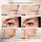 Microcurrent Facial Device with Red Light &Cooling for Puffiness