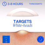 Right Away Thincognito Invisible Spot Patch - Absorbing Hydrocolloid Pimple Patch for Face, Blemishes, Zits, Acne