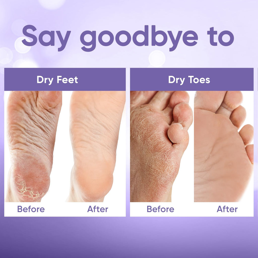 Foot Peeling Mask for Dry Cracked Feet | Foot Mask to Exfoliate Rough, Cracked, Dry Feet, Calluses for Soft Baby Feet