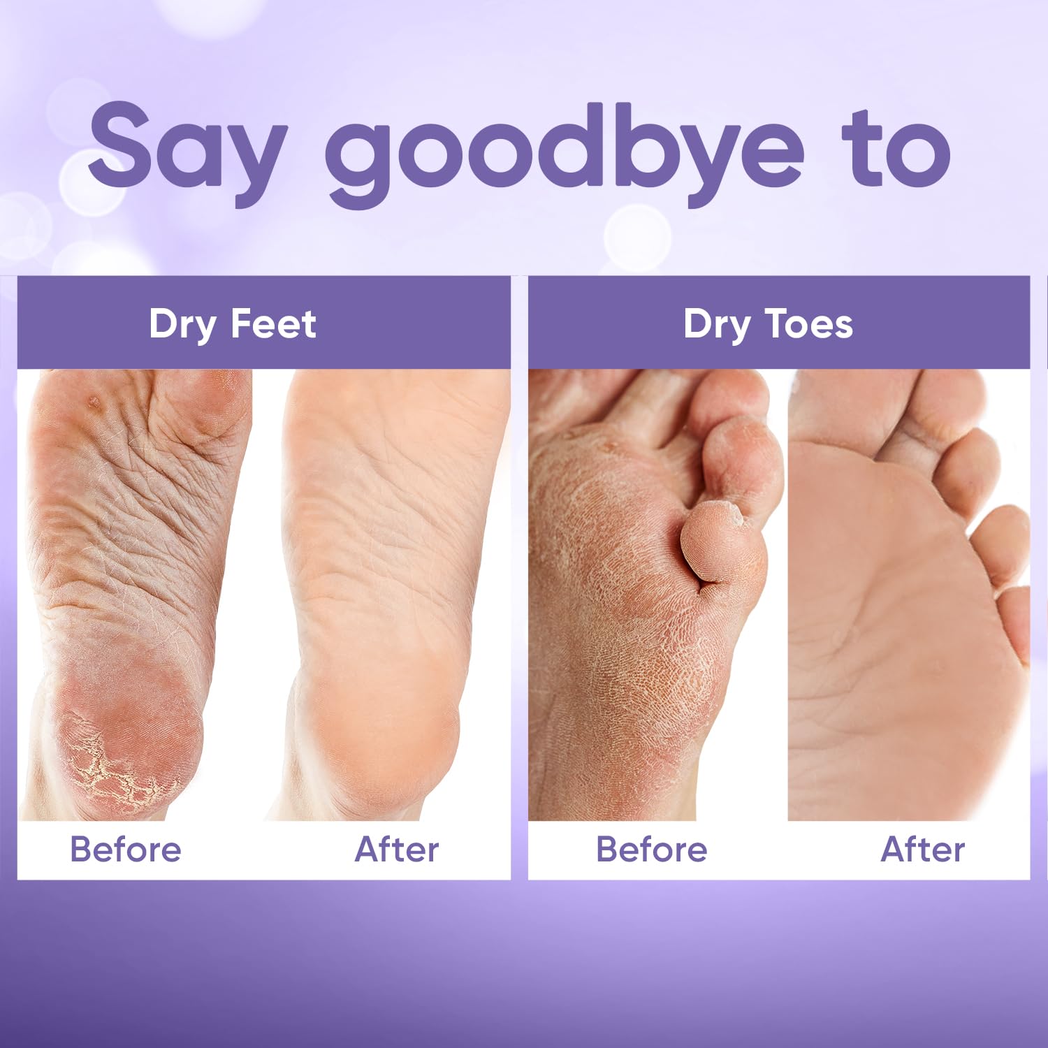 Foot Peeling Mask for Dry Cracked Feet | Foot Mask to Exfoliate Rough, Cracked, Dry Feet, Calluses for Soft Baby Feet