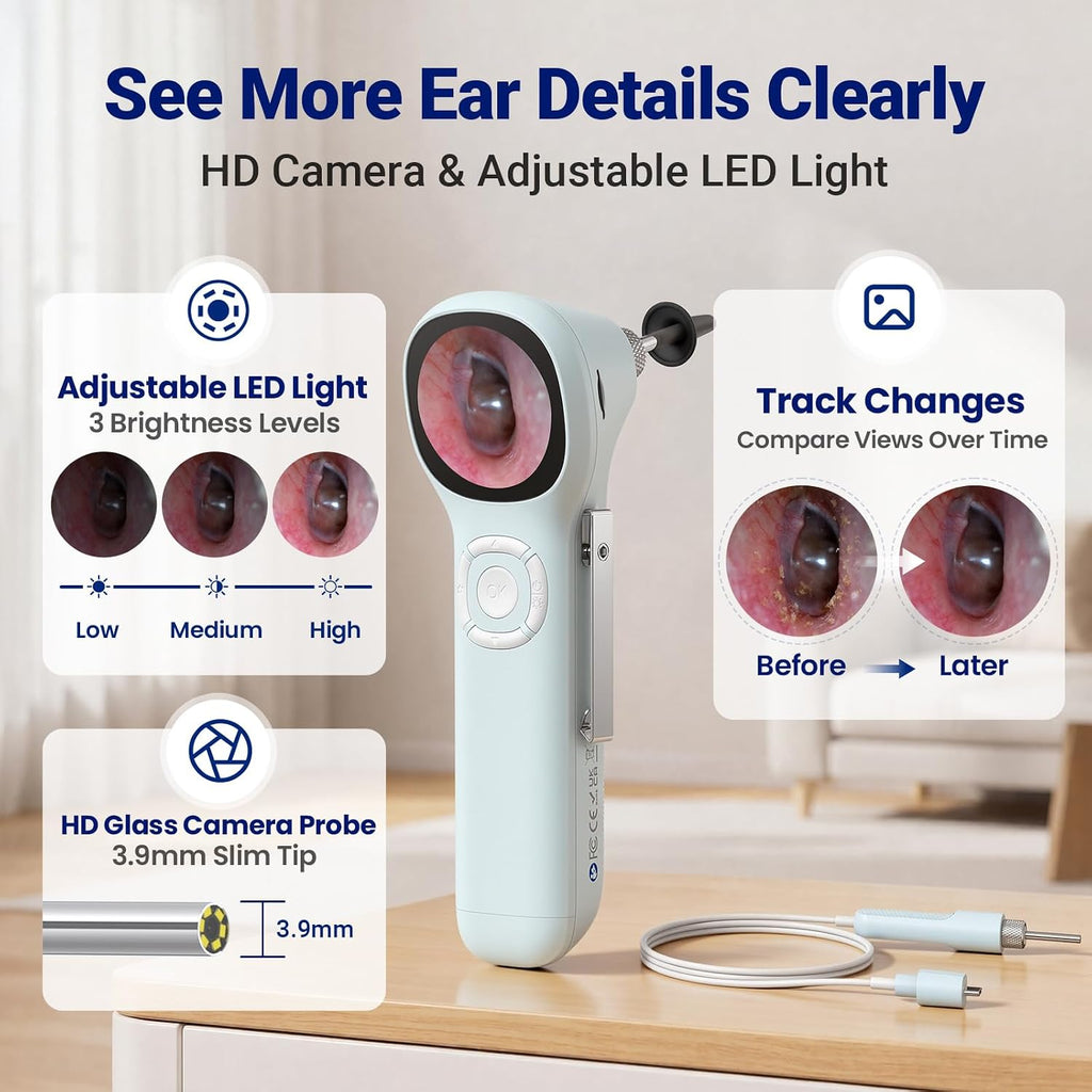 Otoscope with Light, No App Needed, HD Screen, Ear Scope Camera for Family