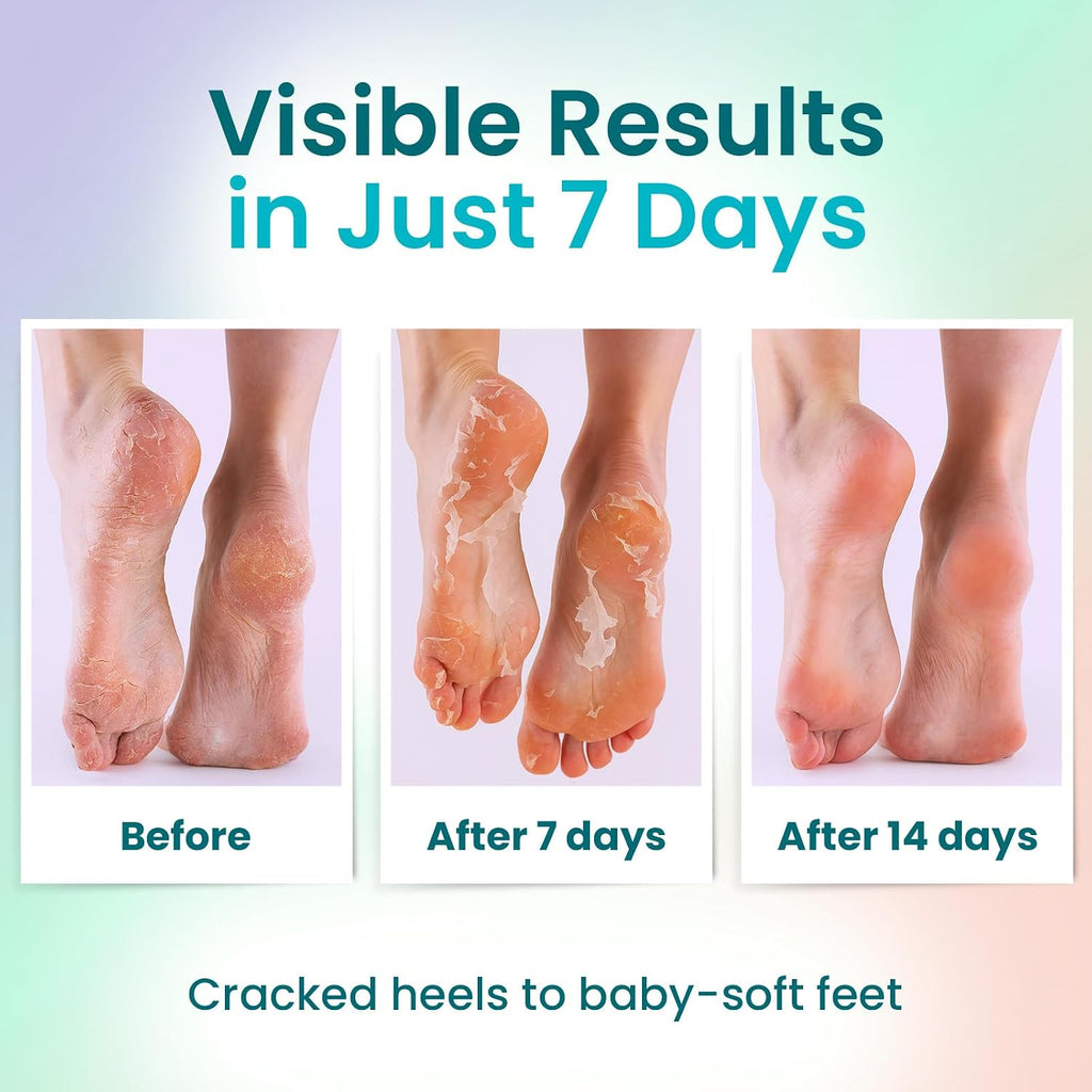 Foot Peeling Mask (6 pairs) Exfoliating Foot Mask for Dry Cracked Feet with Lavender, Aloe Vera, Peach & Shea Butter